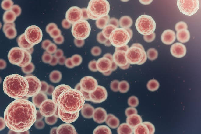 Cancer cases worldwide will soar in the coming decades, a report finds. Here’s why.
