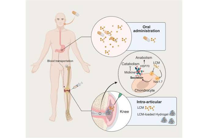 Injectable hydrogel relieves osteoarthritis pain and repairs cartilage in preclinical tests