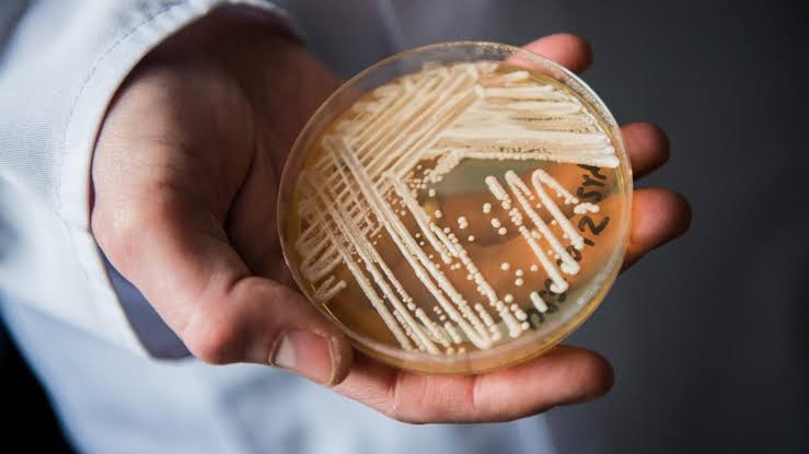 Cases of potentially deadly fungus detected in 27 states, CDC data shows. What to know