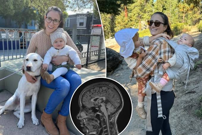 Exclusive | Doctors told me I had anxiety — I was relieved to finally get diagnosed with a brain tumor