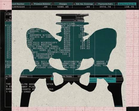 ‘They’ll pay anything to feel better’: the expensive problem of pelvic pain