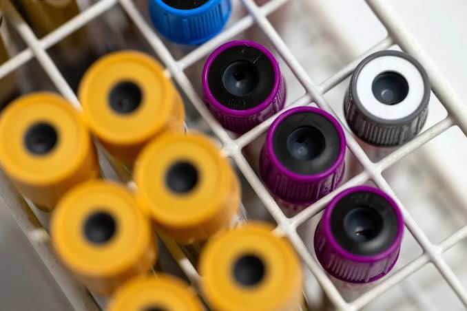 Deadly parasite linked to cancer-like tumors detected in the Pacific Northwest