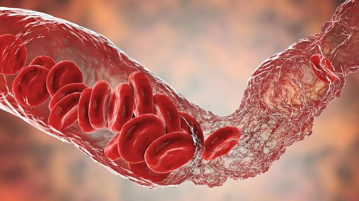 Scientists finally crack mystery of rare COVID vaccine blood clots