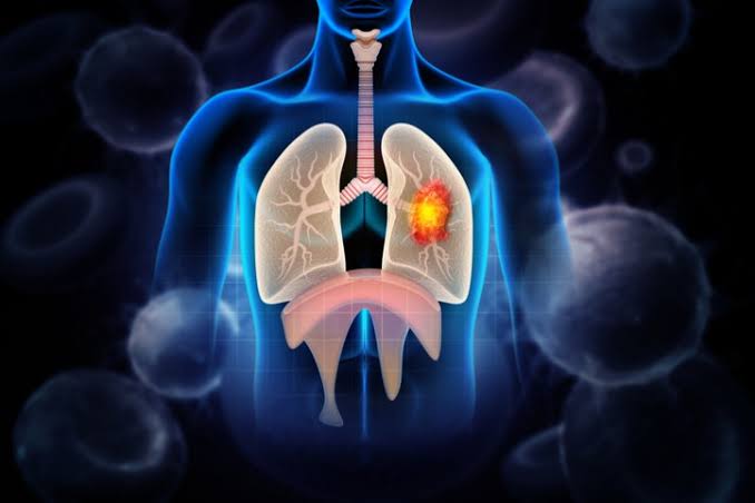 Nature Medicine retracts Chinese lung cancer immunotherapy timing study