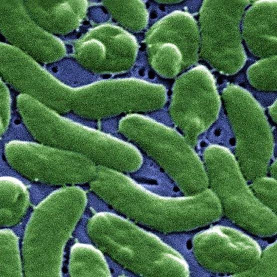 5 dead, 4 hospitalized from Vibrio, a flesh-eating bacteria found in coastal Louisiana waters