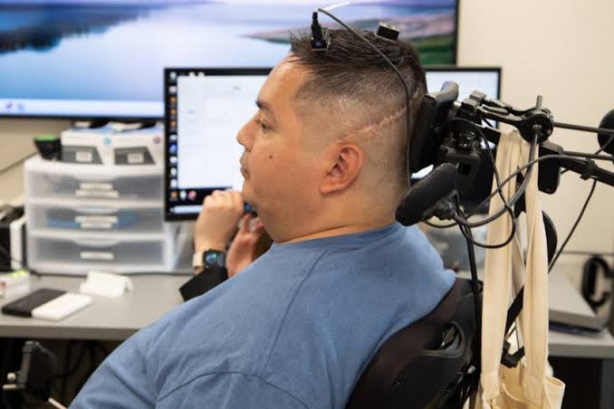 Neurostimulation restores feeling in paralysed hand for months after