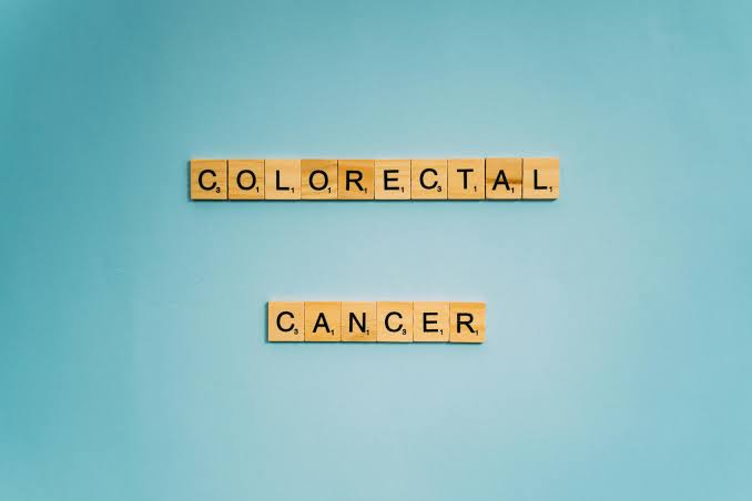 Rectal cancer is striking earlier and killing faster