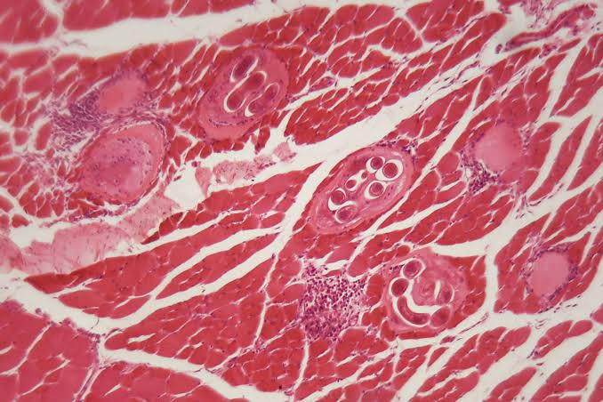 Tainted Jerky Caused an Outbreak of Bear Worms