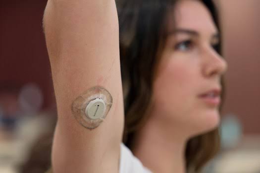 Can wearing a glucose monitor make you healthier? Here’s what happened to UCSD students who did