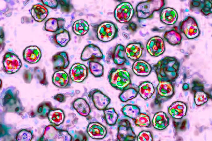 U.S. Measles Cases Reach Over 2,200—Nearly Totaling All Measles Cases Recorded In 2025