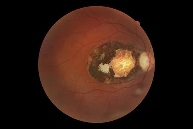 Cat parasite infecting third of humans is ‘major cause of vision loss’, scientists warn