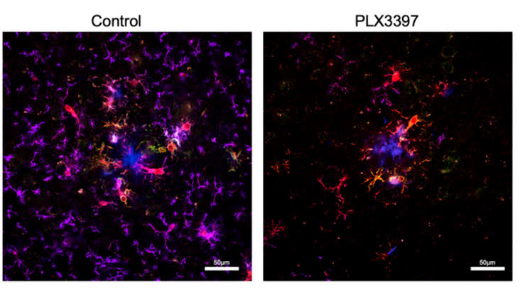 UK doctors say breakthrough in Alzheimer’s research may have found way to restore sleep