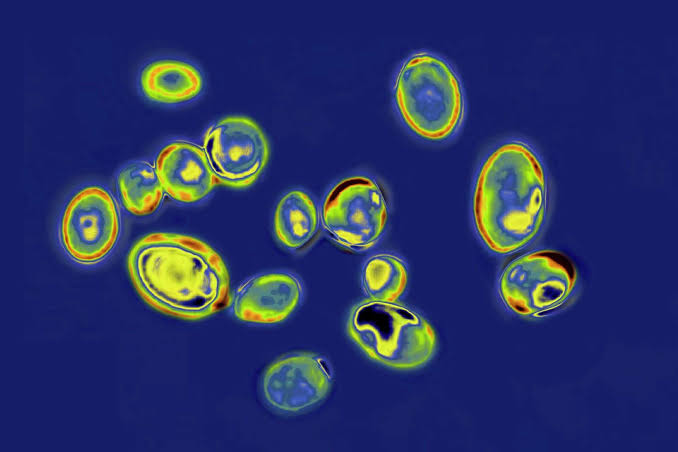 Texas leads nation in Candida auris cases as the drug-resistant fungus spreads