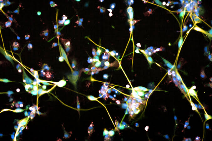 Brain cancer breakthrough as new study finds cell therapy could target deadly glioblastoma