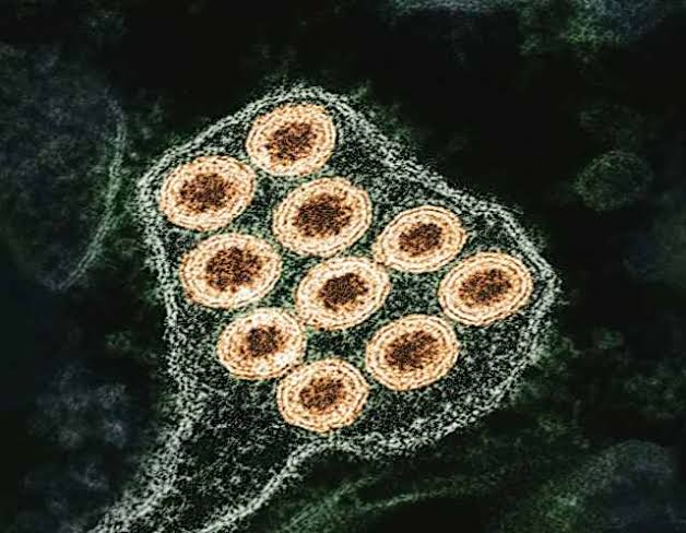 Skunk tests positive for rabies after biting resident in Oakland County