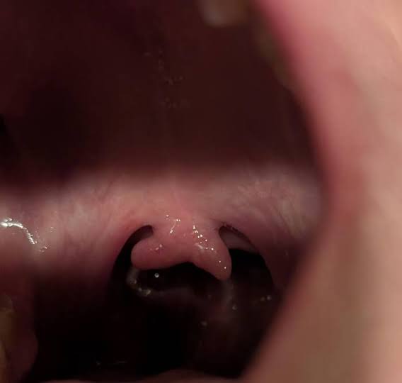 28 Jaw-Dropping Pictures Of The Human Body That Will Completely And Totally Change Your Perspective On Life
