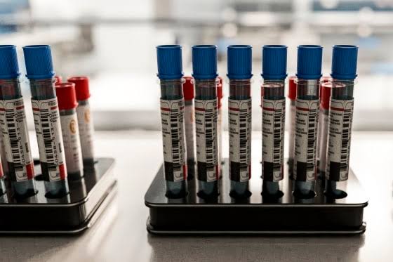 Patients say they want Alzheimer's blood tests. Doctors aren't sure they help.