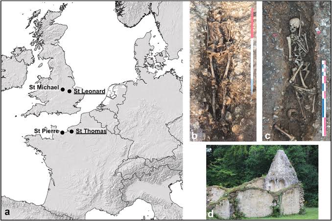Medieval teeth open a new perspective on leprosy care and toxic medicine