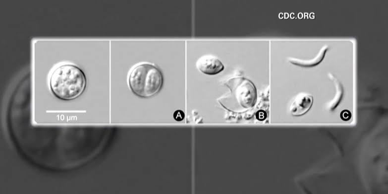 Cyclosporiasis outbreak spreads to 34 states; Arizona reports 19 cases