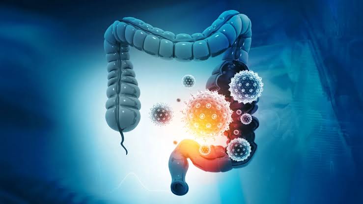 Goodbye colonoscopy? New stool test detects 90% of colorectal cancers