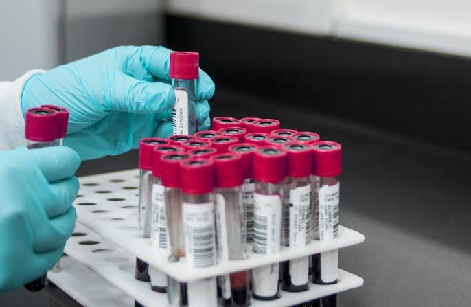 A New Way to Lower High Cholesterol Levels is Found