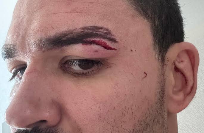 Karate Combat loses fight after Patricky Pitbull suffers cut in brawl: ‘What a f*cking coward move’