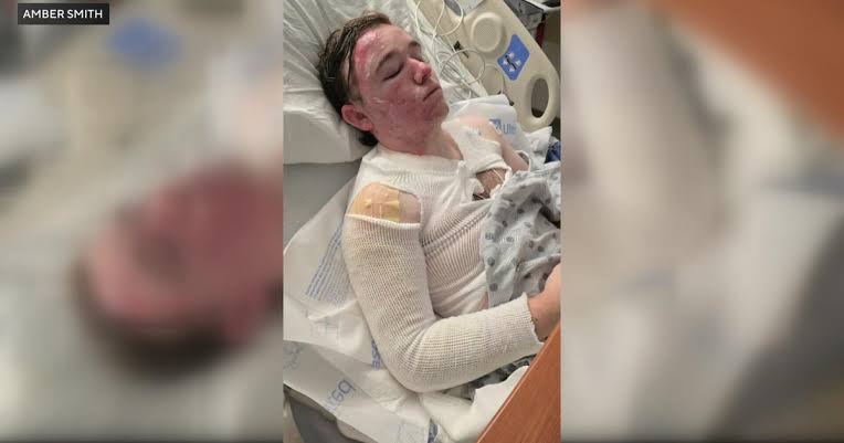 Yuba City McDonald's employee hospitalized after coworker threw hot oil on him, police say