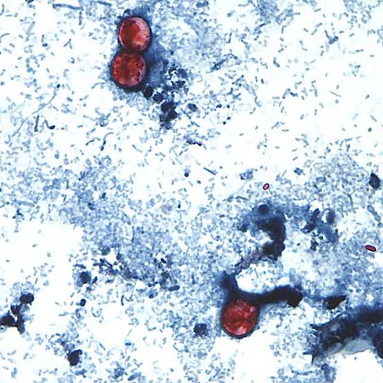 Cyclospora confusion? Four questions about the parasite in Minnesota, answered