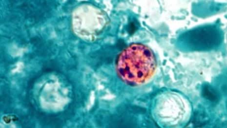 Former FDA official says US handling of cyclospora near ‘catastrophic level’