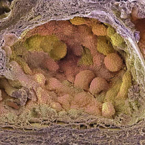 For prostate cancer patients set on surgery, new hormone regimen may improve outcomes, study finds