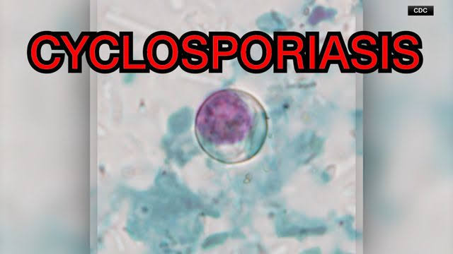 Cyclosporiasis outbreak: What you need to know