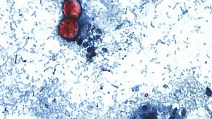 Federal health officials have investigated 5 different clusters of cyclosporiasis cases, FDA says
