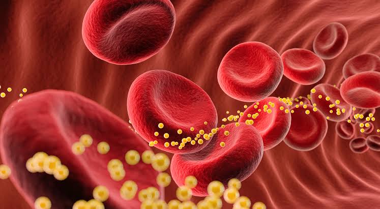 Bad cholesterol slashed 62% by single dose of gene-editing drug in small trial