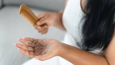 Q32’s stock jumps 60% on latest phase 2 alopecia data for potential rival to JAK inhibitors