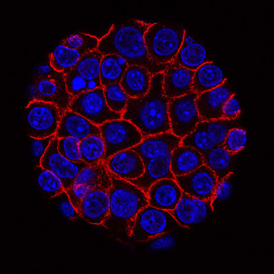 Combination of pancreatic cancer drugs from Tango, Revolution leads to high response rate