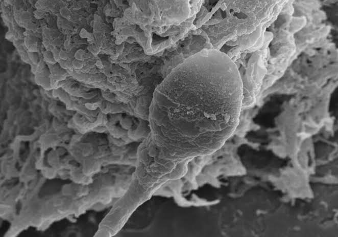 Sperm Get Lost in Space and Scientists Finally Know Why