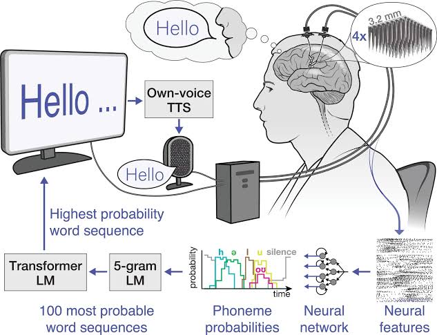 Brain-computer interface enables independent, accurate communication for man living with ALS