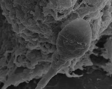 Sperm get lost in space, Australian research into microgravity impacts suggests
