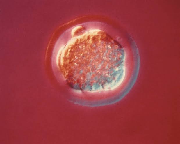 Technical milestone or designer baby obsession: Latest gene-editing advance reignites a familiar ethical debate