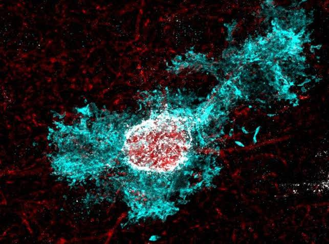 Cortisol Pathway Discovered to Close Early Brain Plasticity