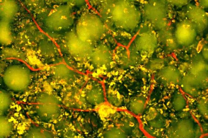 Injectable biomaterial harnesses the immune system to promote brain repair after stroke