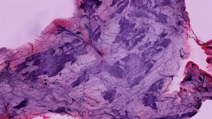 New 3D microscope technology captures high-resolution tissue images at a fraction of the cost