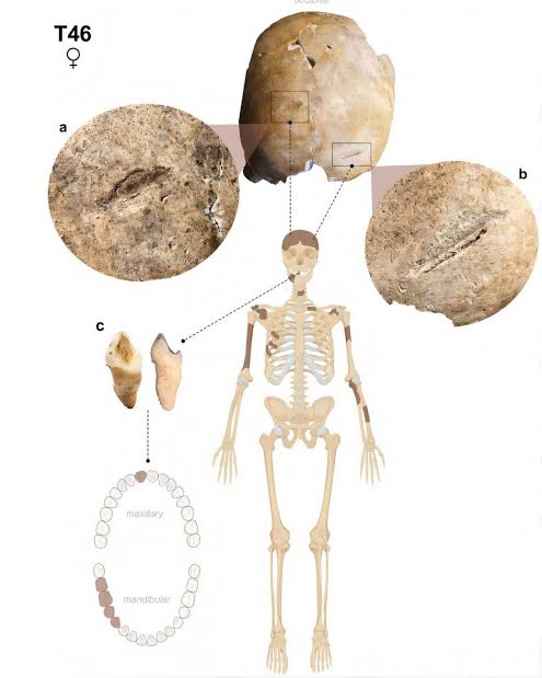 First deliberately injured Langobard woman in skeletal record reshapes view of male-only violence