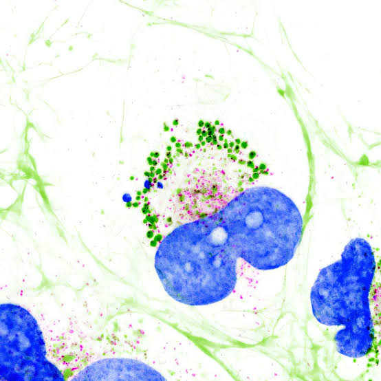Scientists discover collagen, the human body's most abundant protein, is liquid-like inside cells