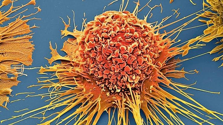 Chemo-Free Technique Destroys 99% of Cancer Cells in The Lab