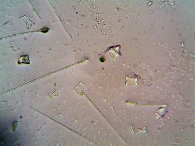 Complex life may have started before Earth had much oxygen at all. A University of Bristol-led Nature study found that the ancient archaeal lineage behind all plants, animals and fungi began developing complex cellular machinery in anoxic oceans almost 2.9