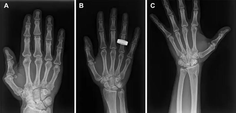 See the first x-rays of humans taken in space
