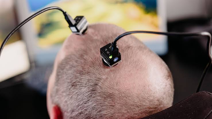 This man with ALS is "the first power user" of a brain implant that lets him speak