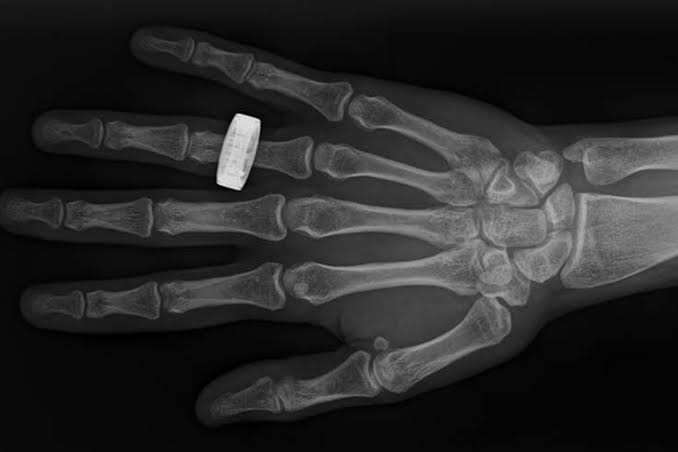 These Look Like Ordinary X-Rays. They’re Not