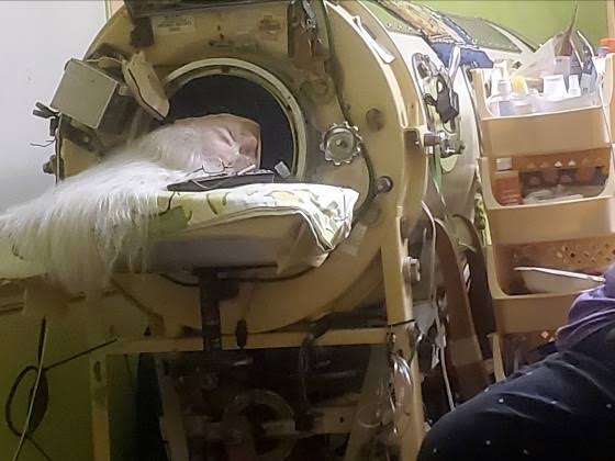 Last U.S. polio patient with an iron lung dies at 78 in Oklahoma